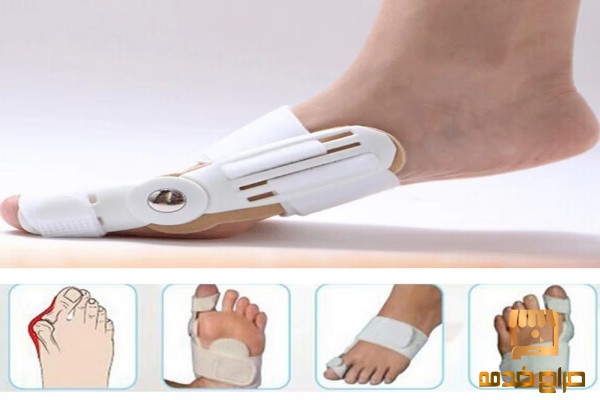 علاج انحراف صابع القدم
